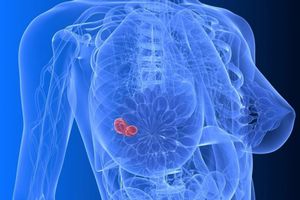 Со 2 по 8 октября в Югре будет проходить Неделя борьбы с раком молочной железы