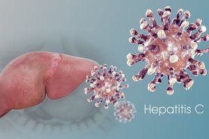 Гепатит С